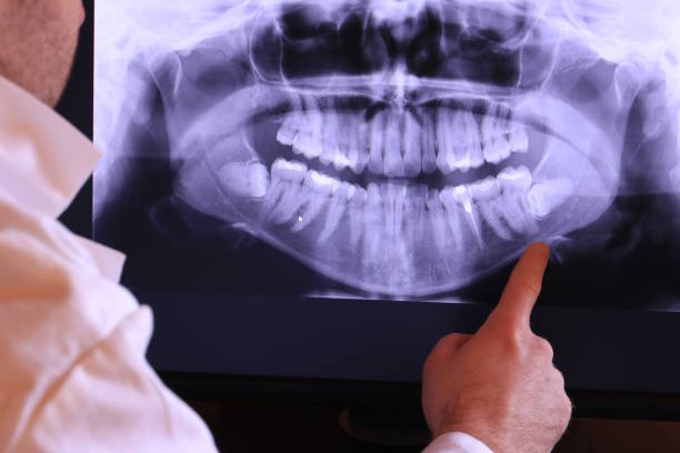 Best Emergency Tooth Extraction in Westport, NC