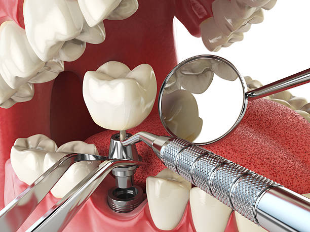 Best Emergency Dental Surgery in Westport, NC