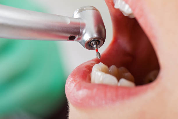 Best Emergency Broken Tooth Repair in Westport, NC